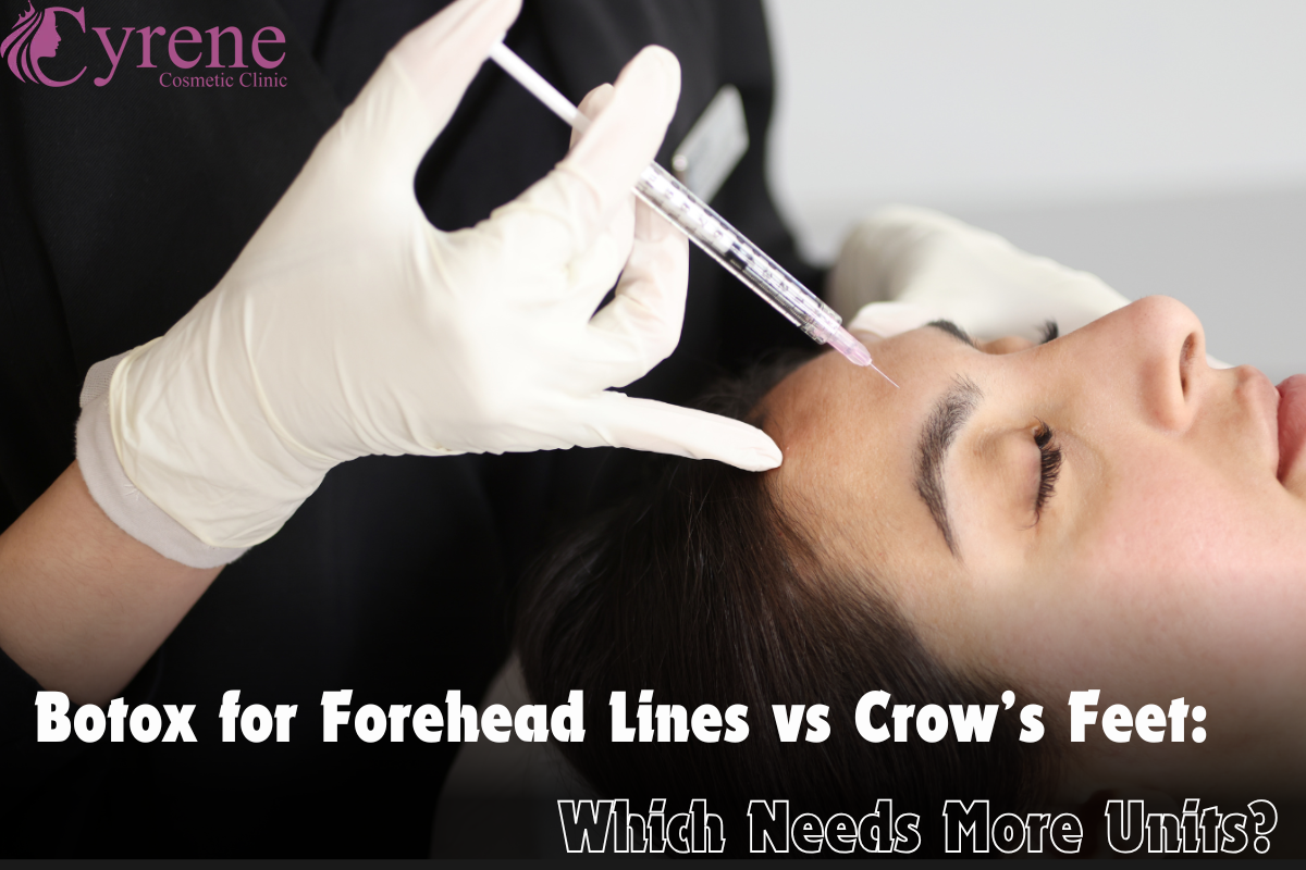 Botox For Forehead Lines Vs Crow’s Feet Which Needs More Units