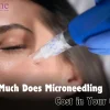How Much Does Microneedling Cost In Your City