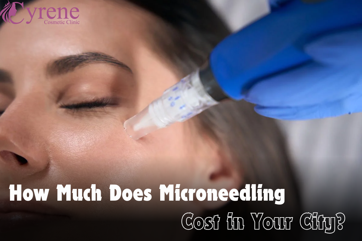 How Much Does Microneedling Cost In Your City