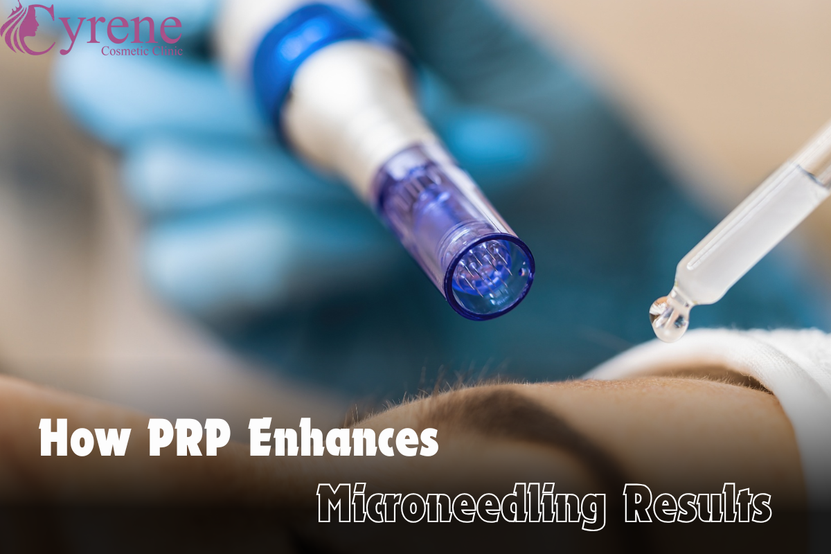 How Prp Enhances Microneedling Results
