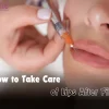 How To Take Care Of Lips After Fillers