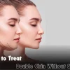 How To Treat Double Chin Without Surgery