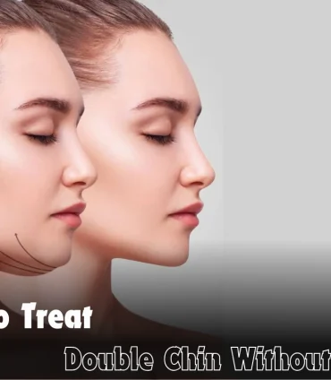 How To Treat Double Chin Without Surgery