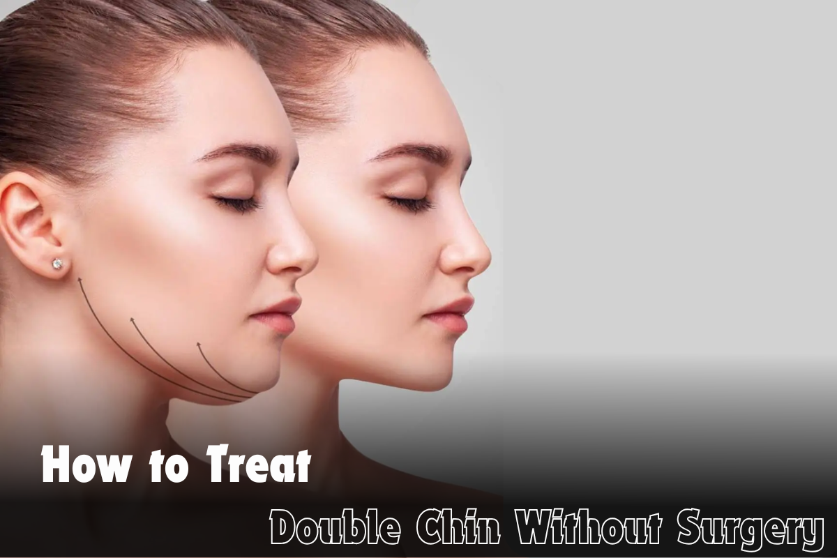 How To Treat Double Chin Without Surgery