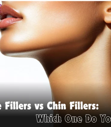 Jawline Fillers Vs Chin Fillers Which One Do You Need