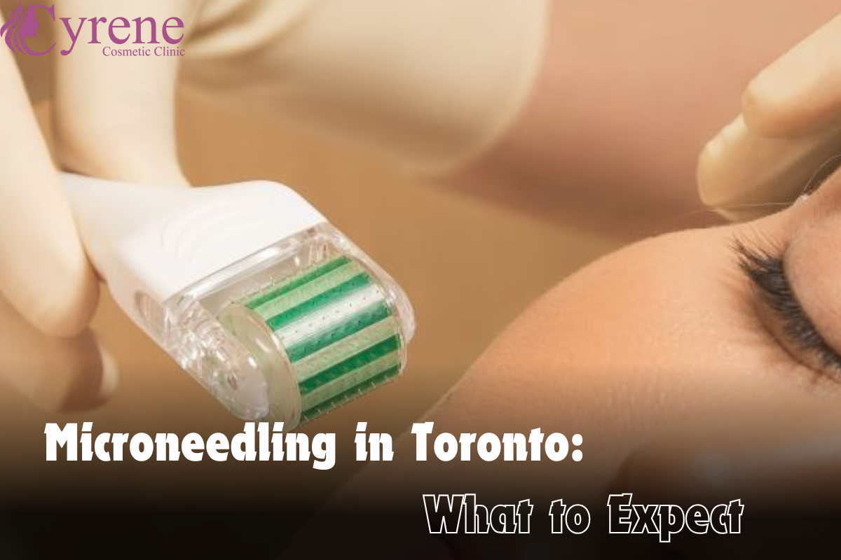 Microneedling In Toronto What To Expect