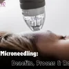 Prp Microneedling Benefits, Process & Results