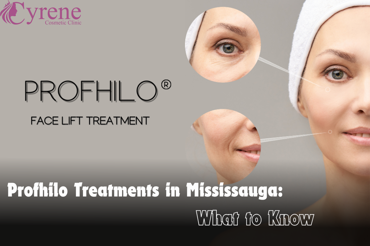 Profhilo Treatments In Mississauga What To Know