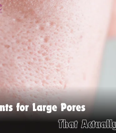 Treatments For Large Pores That Actually Work