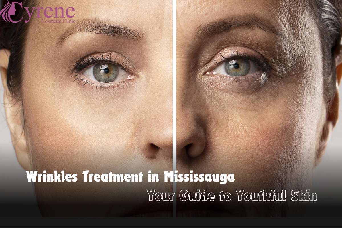 Wrinkles Treatment In Mississauga Your Guide To Youthful Skin